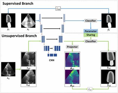 An improved contrastive learning network for semi-supervised multi-structure segmentation in echocardiography